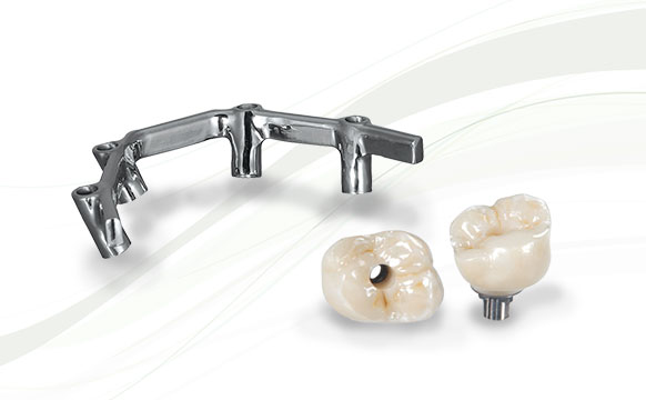 Inclusive Screw-Retained